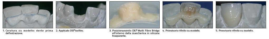 DEI® experience Multi Fibre Bridge fibre multidirezionali DEI italia